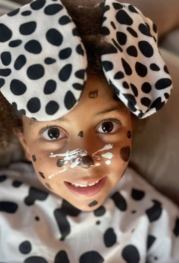 kid in dalmatian costume