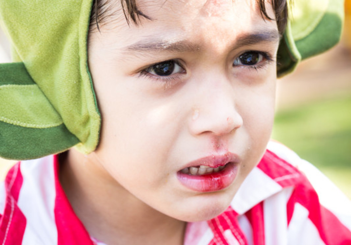 what-to-do-when-your-child-knocks-out-a-tooth-macaroni-kid-overland