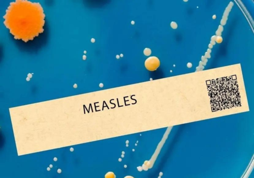 Measles Outbreak